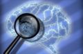 Área de Broca del cerebro