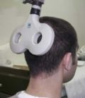 Estimulación craneal