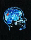 Cerebro y sueño